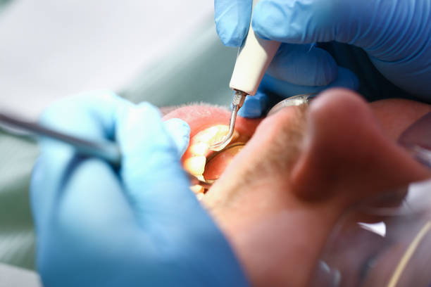 Best Same-Day Emergency Dental Services in Alum Creek, WV