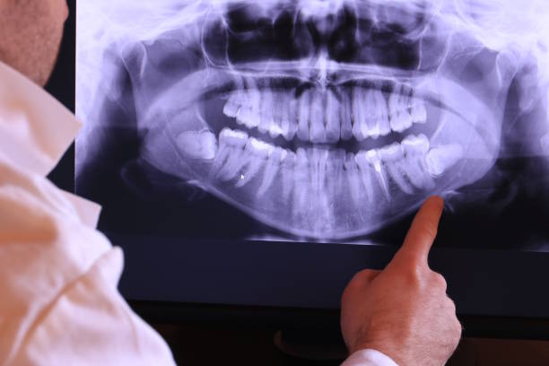 Best Emergency Tooth Extraction in Alum Creek, WV
