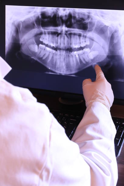 Best Emergency Tooth Extraction in Alum Creek, WV