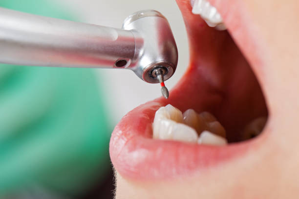 Best Emergency Treatment for Dental Infections or Abscesses in Alum Creek, WV